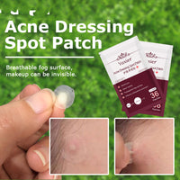 Hydrocolloid Acne Patches – Invisible Blemish Spot Stickers for Targeted Skincare
