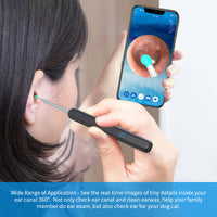 Wireless Ear Cleaning Camera – Otoscope Ear Wax Removal Tool with LED Light & App