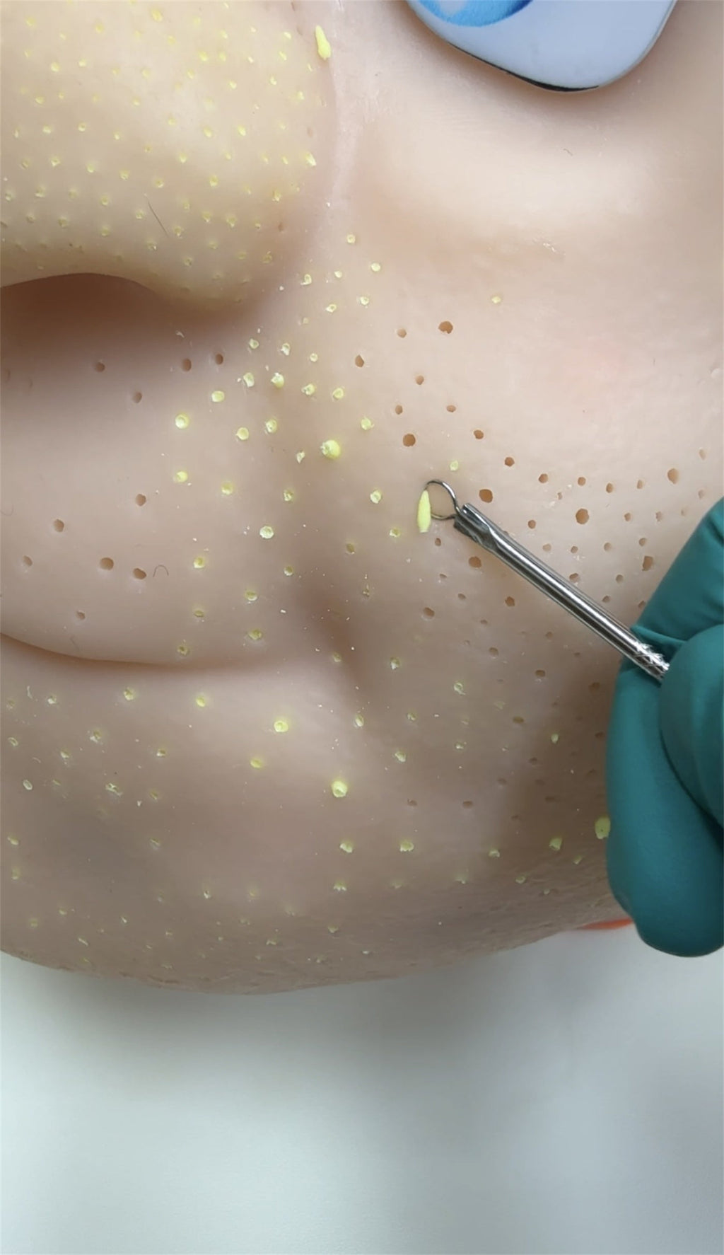 Eco‑Friendly Realistic Acne Popping Stress Relief Toy – Big Head Pimple Squeezer What Else You Got?