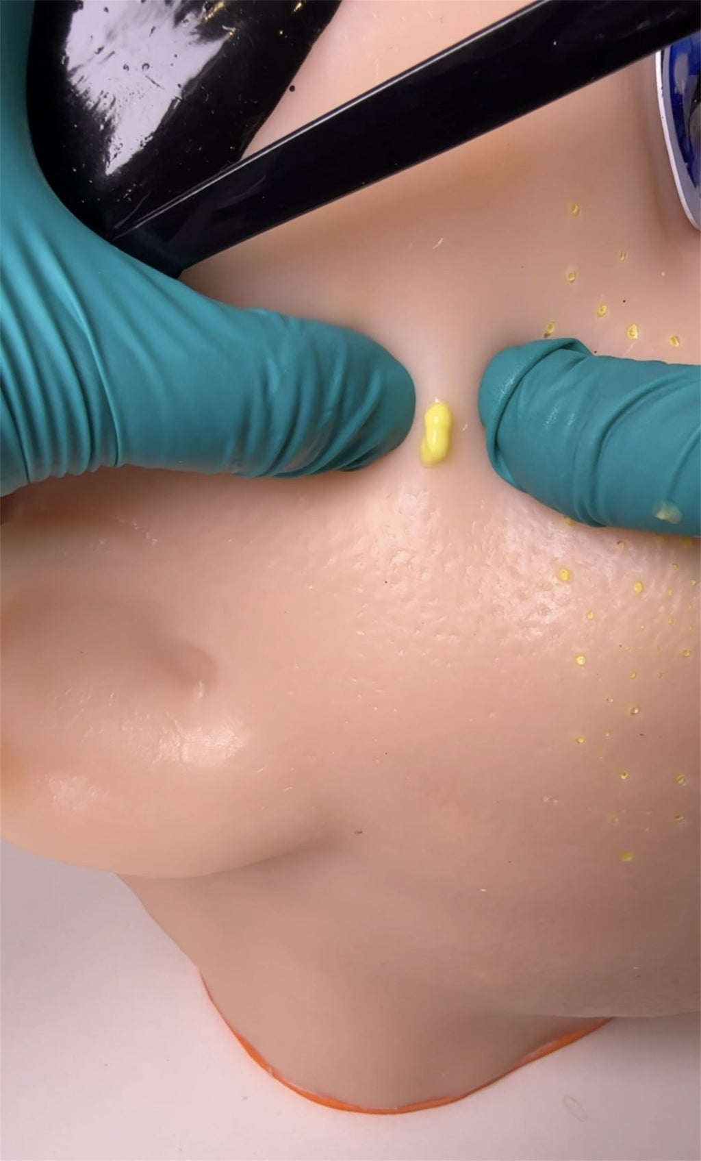 Eco‑Friendly Realistic Acne Popping Stress Relief Toy – Big Head Pimple Squeezer What Else You Got?