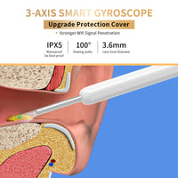 Wireless Ear Cleaning Camera – Otoscope Ear Wax Removal Tool with LED Light & App