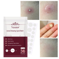 Hydrocolloid Acne Patches – Invisible Blemish Spot Stickers for Targeted Skincare