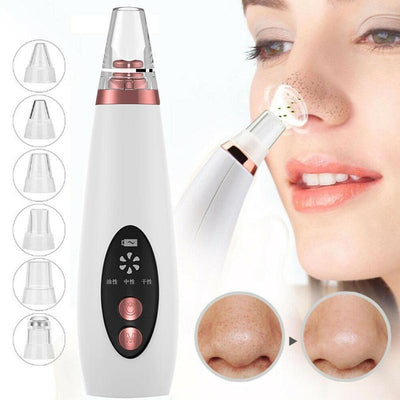 Blackhead Remover Vacuum – 53kPa Electric Pore Suction Cleanser with 4 Heads | Deep Cleanse & Acne Treatment