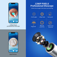Wireless Ear Cleaning Camera – Otoscope Ear Wax Removal Tool with LED Light & App